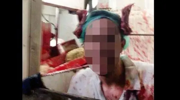 عکسی خون آلود که جنجال به راه انداخت ! + جزییات