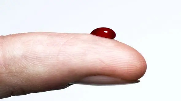 ارتباط مصرف مواد نگهدارنده غذا با افزایش خطر ابتلا به دیابت نوع 2