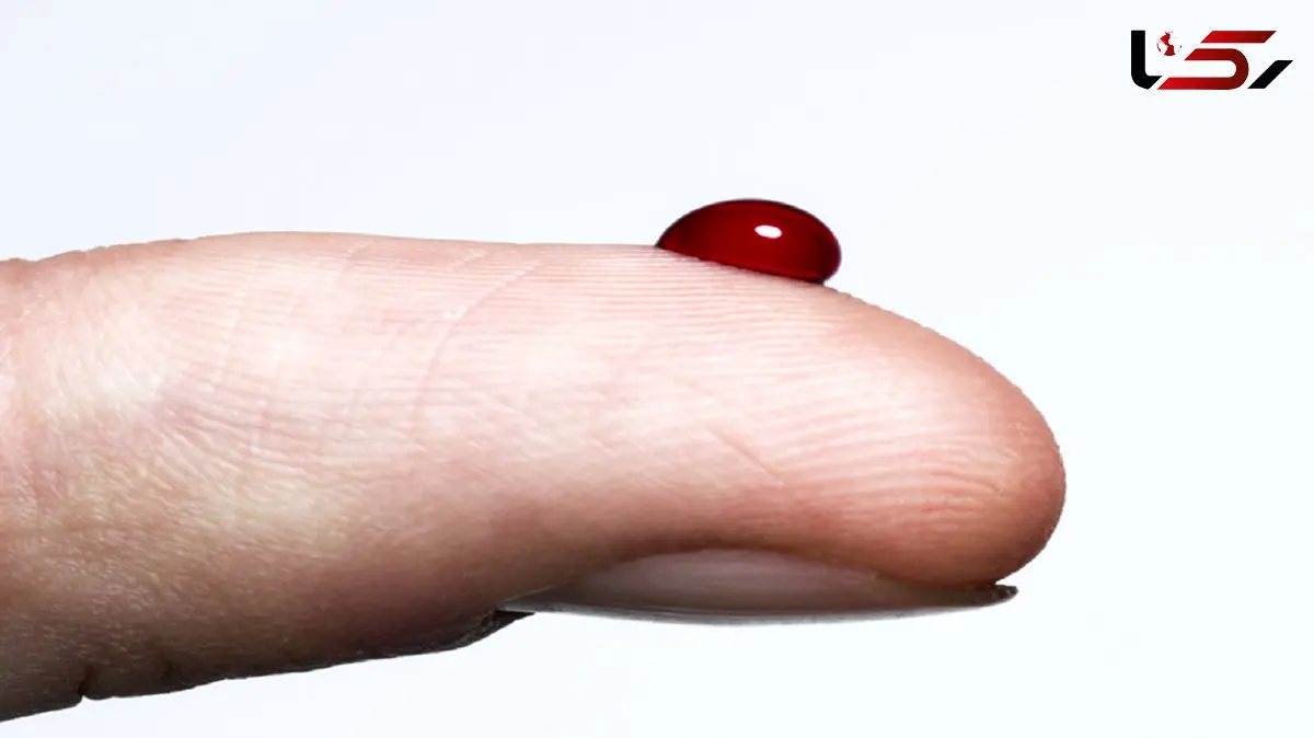 ارتباط مصرف مواد نگهدارنده غذا با افزایش خطر ابتلا به دیابت نوع 2