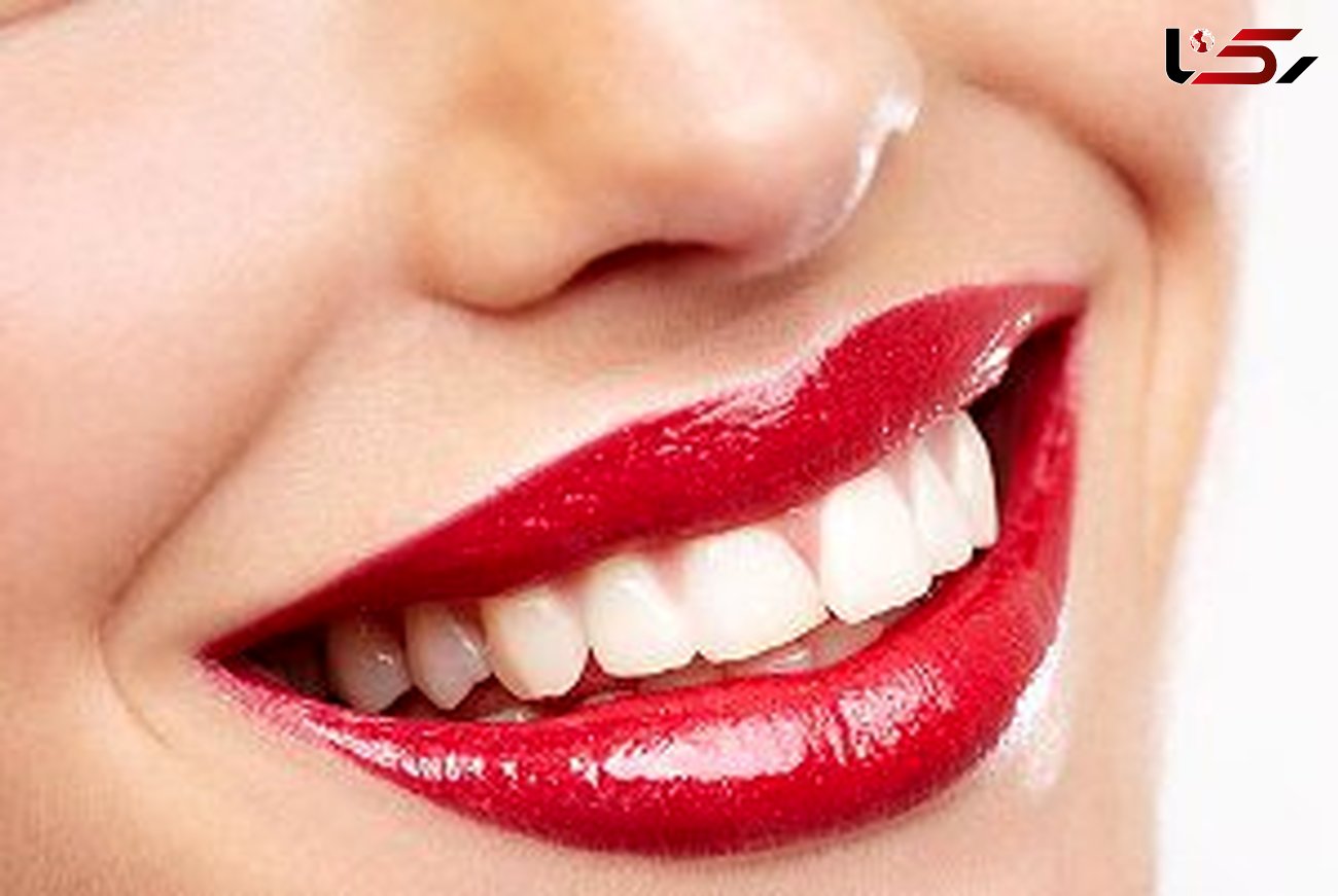 راه های ارزان و موثر برای سفید کردن دندان 