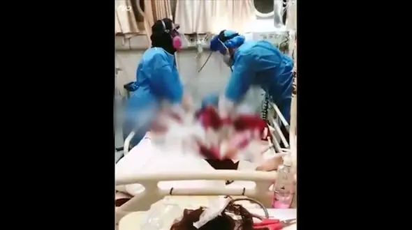 احیا بیمار کرونایی در بیمارستان شهدای یافت آباد + فیلم