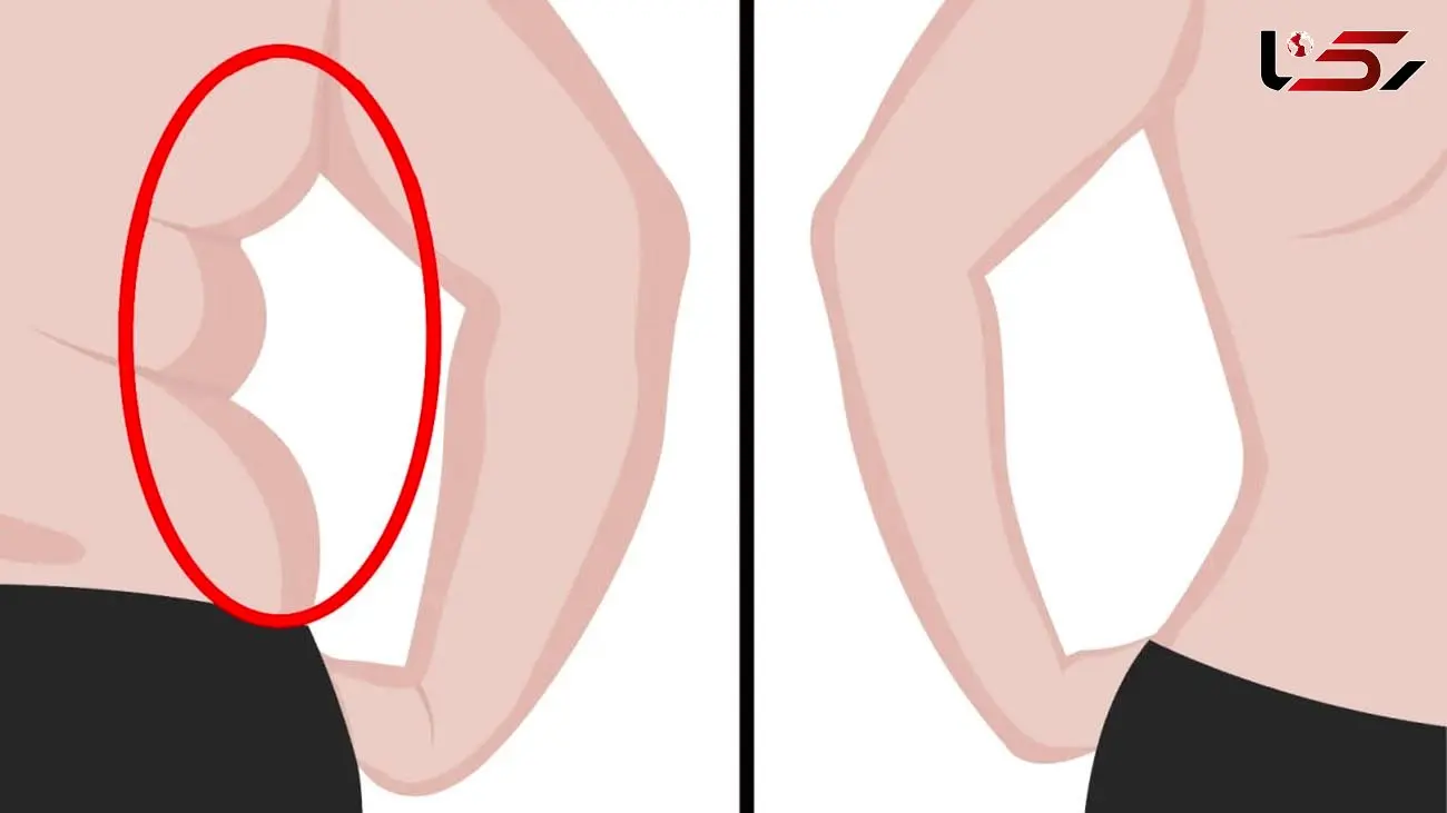 چگونه بفهمیم داریم چربی سوزی می کنیم؟