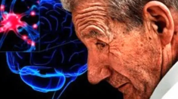 مهم ترین عامل خطر ابتلا به پارکینسون