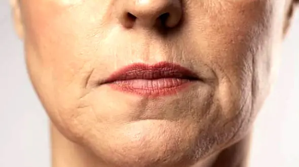 این زن به خاطر پیر نشدن 40 سال نخندید! / از چروک صورت وحشت دارد ! + عکس