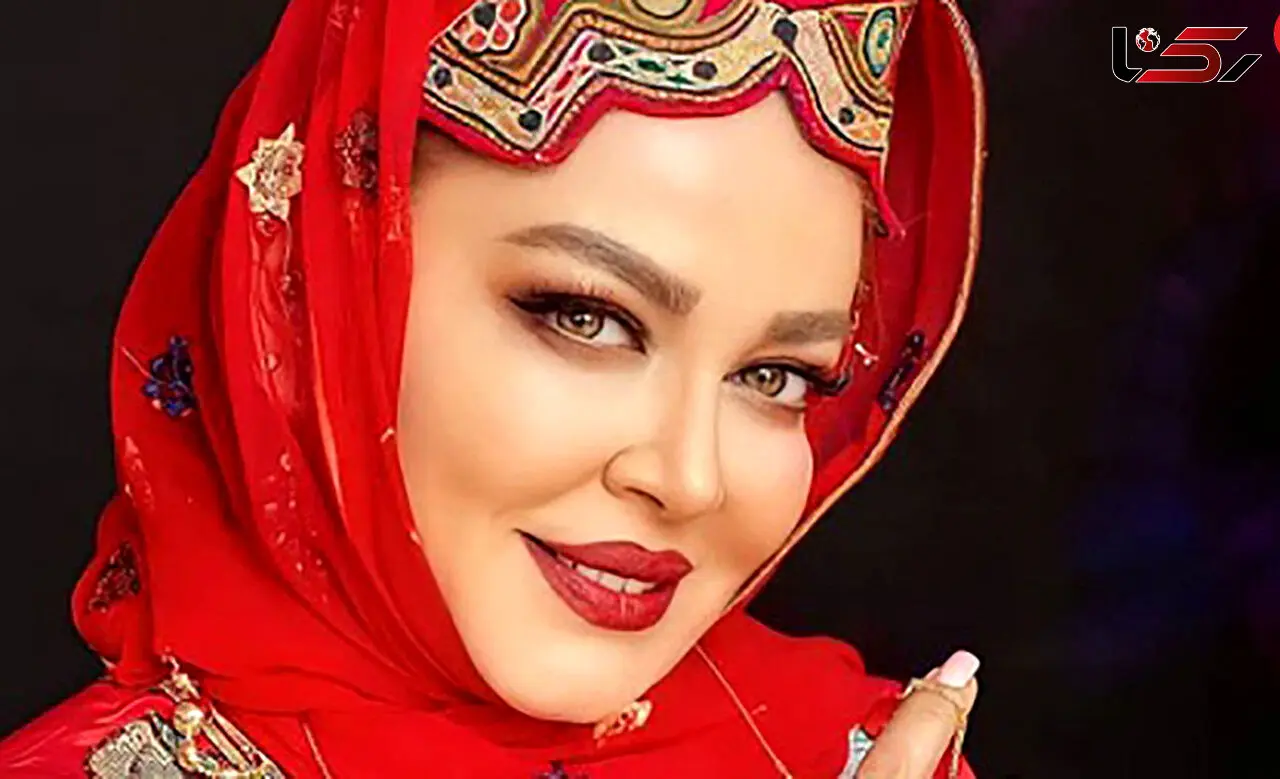 بهاره رهنما صورتش را کوبید و از نو ساخت ! + عکس حیرت آور