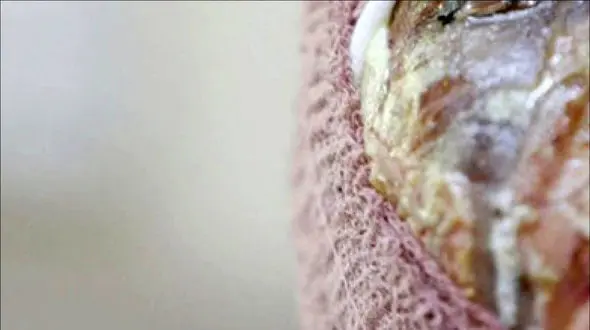 زن جوان مشهدی محکوم به کوری دو چشم شد / باید حدقه چشمان این ورزشکار زن باقی بماند !