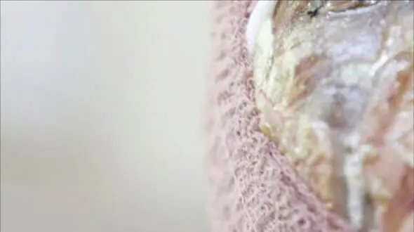 زن جوان مشهدی محکوم به کوری دو چشم شد / باید حدقه چشمان این ورزشکار زن باقی بماند !