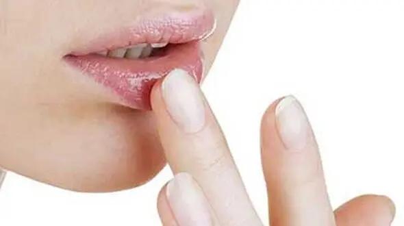 شایع ترین دلایل پوسته پوسته شدن لب ها 