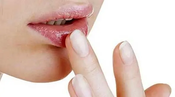 شایع ترین دلایل پوسته پوسته شدن لب ها 