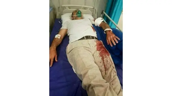 حمله خونین با قمه به رئیس شورای شهر بومهن + عکس 