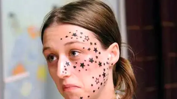 56 ستاره خالکوبی شده روی صورت دختر جوان دردسر ساز شد