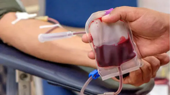 فصد خون چیست؟ + جدول معایب و مزایا فصد خون