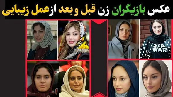 فیلم تغییر چهره  خانم بازیگران بعد از عمل زیبایی  ! / اینها اونها نیستند !