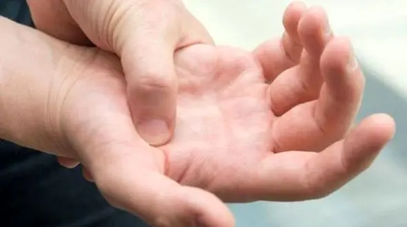 دلایل و علائم سندرم تونل کارپال + نکات درمانی