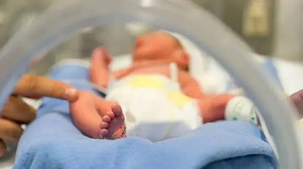 جراحی جنین در بدن جنین / در کرمانشاه رخ داد