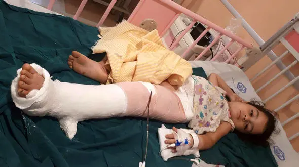 سقوط کودک از طبقه سوم در قائم شهر/ او شب ها در خواب راه می رفت +عکس