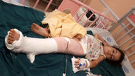 سقوط کودک از طبقه سوم در قائم شهر/ او شب ها در خواب راه می رفت +عکس