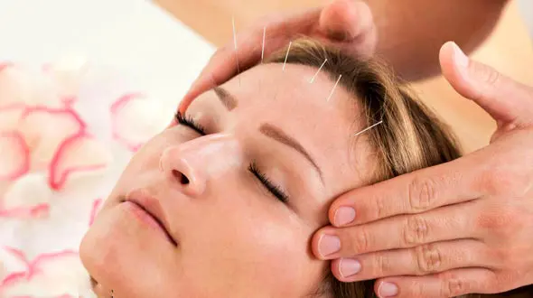 رفع چین و چروک صورت با طب سوزنی