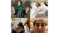تکه پاره شدن  خانم آرایشگر تهرانی در حمله سگ لاکچری همسایه + گفتگوی اختصاصی و فیلم لحظه حمله