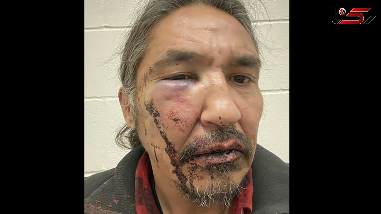 ضرب و شتم رهبر بومیان کانادا توسط پلیس + عکس