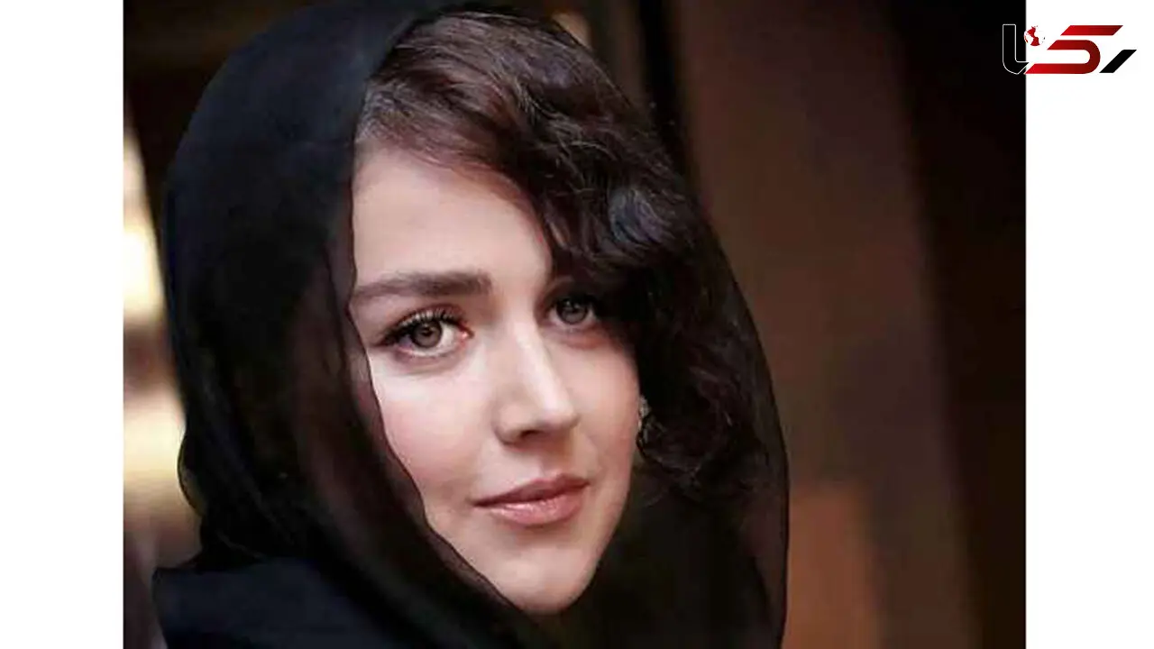  غرور سر به فلک کشیده افسانه پاکرو برای زیبایی صورتش / واقعا چرا؟