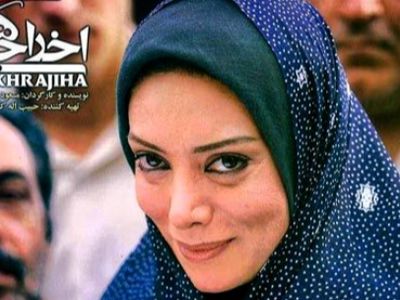 تغییر چهره شدید نگار فروزنده / با بوتاکس و جراحی خودش را 20 سال جوانتر کرد!