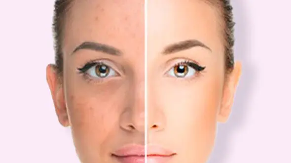 بهترین ماسک صورت روشن کننده و سفید کننده