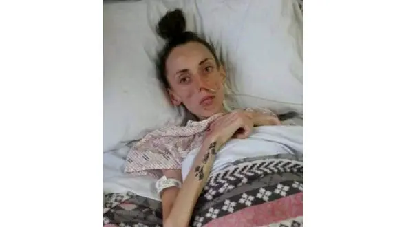 دختر 15 ساله ای که با رژیم لاغری شبیه به پیرزن 60 ساله شد+عکس