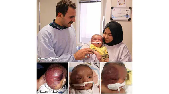 نوزاد عراقی در شهر امام رضا (ع) جان دوباره ای گرفت+ عکس
