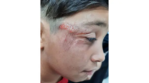 سگ ها دختر بچه مشهدی را دریدند / صحنه ای هولناک جلوی چشمان مادر ؟ + عکس 