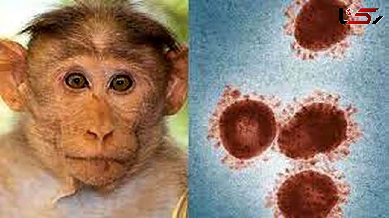 آبله میمون مرگ و میر بالایی ندارد / واکسن دوران کودکی، ۸۵ درصد از ابتلا جلوگیری می کند