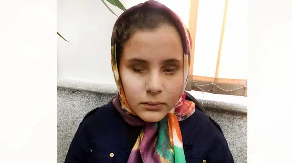گفتگو با دختر 11 ساله که از اجرای حکم کور شدن شوهر عمه اش ابراز رضایت می کند + عکس جدید