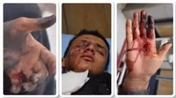 آمار مصدومان چهارشنبه سوری کشور به 2351 نفر رسید/ تأیید 2 مرگ تا این لحظه 