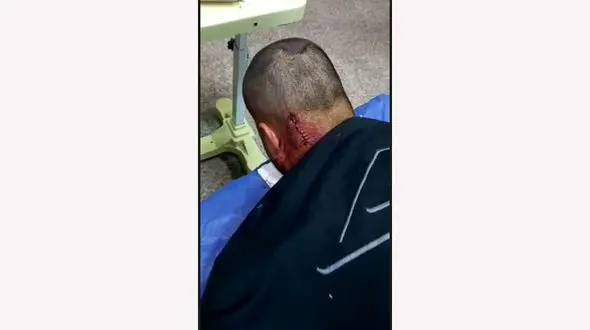 حمله وحشیانه زورگیران خشن به جوان کرجی + فیلم و عکس دلخراش از پشت سر شکافته شده