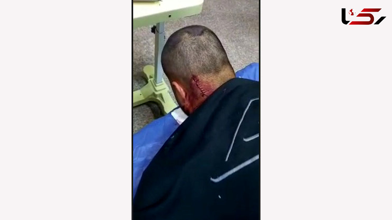 حمله وحشیانه زورگیران خشن به جوان کرجی + فیلم و عکس دلخراش از پشت سر شکافته شده