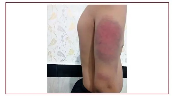 فاجعه روانی در مدارس، وقتی معلم شلاق می‌زند؛ معلم تعرض می کند ! / بی توجهی سیستم آموزشی در برابر روان‌های فرسوده!