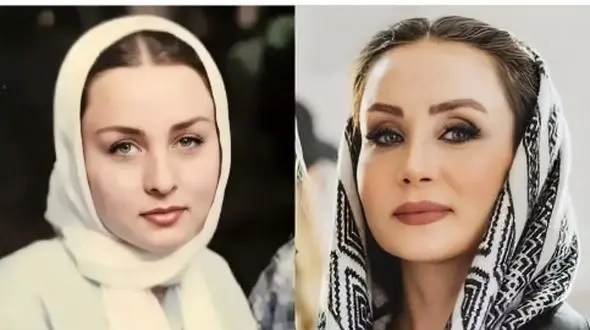 چهره مصنوعی حدیث فولادوند در جدیدترین عکس هایش! / خانم بازیگر میگه عمل نکردم اما...