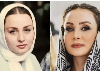 چهره مصنوعی حدیث فولادوند در جدیدترین عکس هایش! / خانم بازیگر میگه عمل نکردم اما...