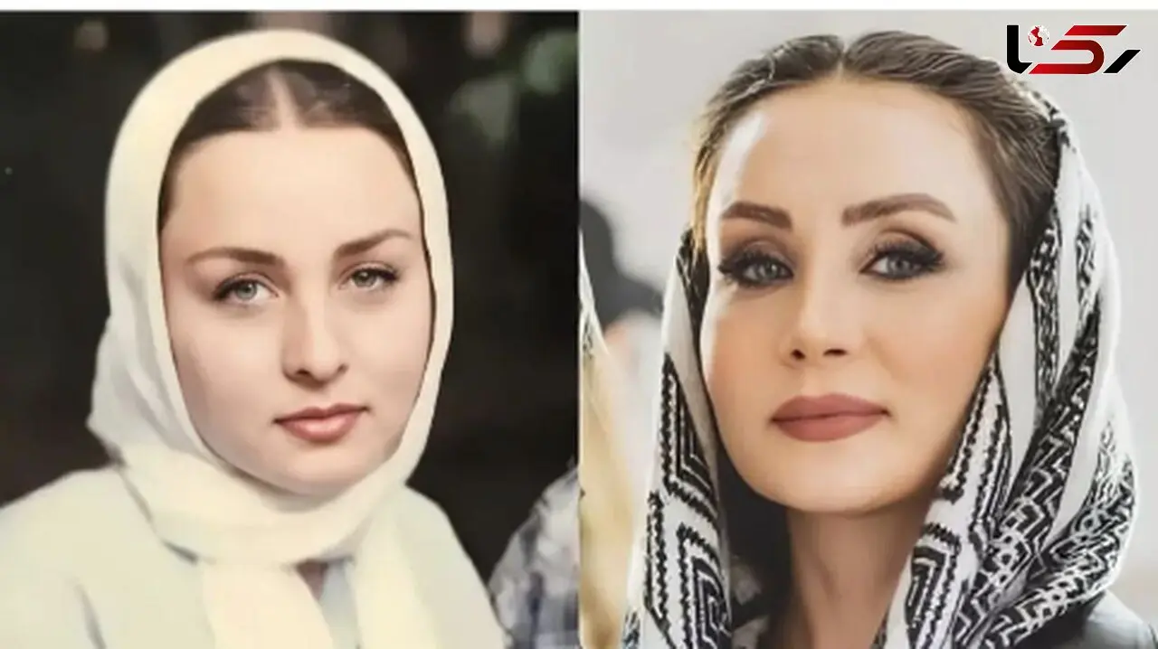 چهره مصنوعی حدیث فولادوند در جدیدترین عکس هایش! / خانم بازیگر میگه عمل نکردم اما...