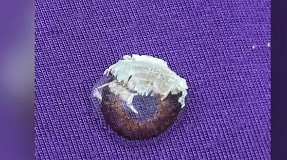 بلایی که یک اشتباه بر سر زن جوان آورد + عکس