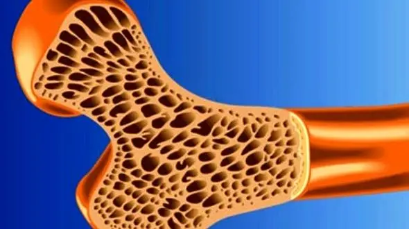 ترمیم استخوان آسیب دیده با داربست پلیمری محقق شد