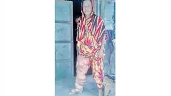 یک پای راضیه 57 کیلو است !