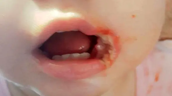 هشدار جدی مادر یک دختربچه به زنانی که فرزند خردسال دارند! + عکس