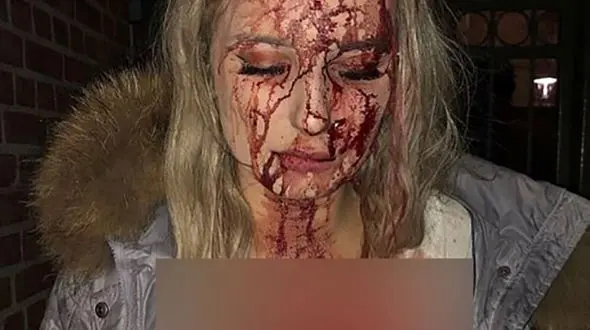 آزار و اذیت دختر 19 ساله در پارتی شبانه / مرد شرور فرار کرد + عکس 