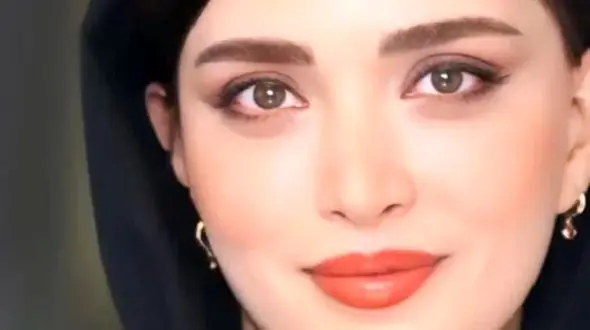 زشتی عجیب بهنوش طباطبایی اوایل بازیگری اش ! / معجزه عمل زیبایی را ببینید !