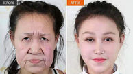 جراحی زیبایی یک پیرزن را به دختری 15 ساله تبدیل کرد + عکس قبل و بعد /چین