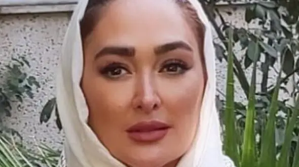 عکسی از الهام حمیدی با صورت کبود