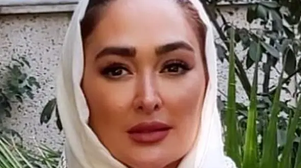 عکسی از الهام حمیدی با صورت کبود