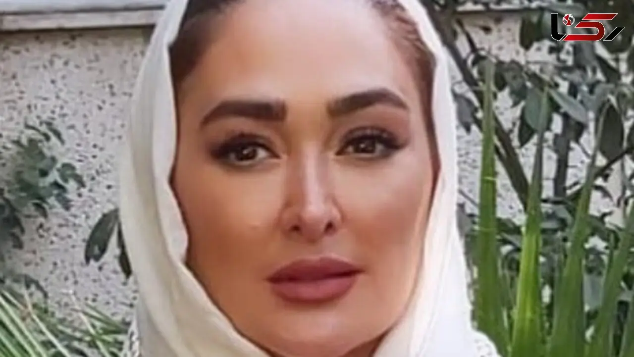 عکسی از الهام حمیدی با صورت کبود