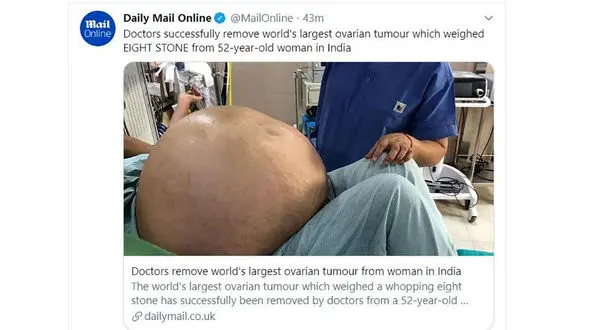 خارج کردن بزرگترین و باورنکردنی ترین تومور تخمدان از شکم یک زن + عکس